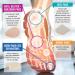 Steins Moleskin Kidney Shaped Ball of Foot Pads - Metatarsal Cushion for Callus & Blisters - 8 Count - Buy Online on GoSupps.com