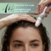 Hair Growth Oil 25ml Root Stimulator Roller - Nourishing Hair Oil | For Women and Men Daily Care Nighttime Shower After-Cut Hair Preparation - Buy Online on GoSupps.com