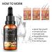 Ginger Hair Growth Serum for Men and Women - Promotes Hair Regrowth, Strengthens Follicles, Thicker, Healthier Hair - Ideal for All Hair Types - Effective Hair Loss Treatment - Buy Online on GoSupps.com