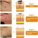 Zoencgz LIPOGO Bee Venom Cream New Bee Venom Treatment Cream Lipogo Professional Bee Venom Repair Cream for All Parts of The Body (1 Pack) - Buy Online on GoSupps.com