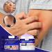 Gentle 30g Itch Relief Cream with Violets Cnidium Extract - Anti-Itch Ointment for Sensitive Dry Skin - Buy Online on GoSupps.com