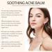 Cr me nourrissante r g n rante pour boutons - 50 g - Baume hydratant apaisant pour femmes et adolescents - Buy Online on GoSupps.com