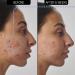 The INKEY List Retinol 1% Serum 30 ml - Buy Online on GoSupps.com