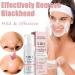 5 in 1 Foaming Cream Cleanser Blackhead Deep Pore Facial Cleansing Mousse Face Cleanser Oily Skin Face Wash with Niacinamide & Hyaluronic Acid Removes Excess Oil Unclogs Pores & Reduces Blackheads - Buy Online on GoSupps.com