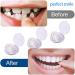 JIAZHOUHB Snap-on Teeth - 2 Pairs of Cosmetic Veneers for Men & Women | Instant Smile Solutions - Buy Online on GoSupps.com