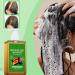 Batana Oil Shampoo Shampoo De Batana Shampoo De Batana Para La Caida Del Cabello Rosemary Oil Shampoo Champu De Batana Batana Oil & Rosemary Shampoo Batana Oil Shampoo with Rosemary Extract (600ml) - Buy Online on GoSupps.com
