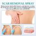 PARHAR Advanced Scar Repair Spray - For Facial Dark Spots, Surgical Scars, Stretch Marks - Relieves Scar Itching - Suitable for All Types of Scars (2PCS) - Buy Online on GoSupps.com