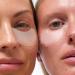 Dissolving Microneedle Eye Patches - 5 Pairs for Dark Circles & Puffiness | Ship Worldwide - Buy Online on GoSupps.com