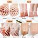 Tongyend Urea Foot Cream Urea 42% Foot Cream Cracked Heel Repair Cream For Dry Hard Skin Callus Remover Foot Moisturiser Nourishes Softens Dry Rough Cracked Dead Skin Foot Care - Buy Online on GoSupps.com