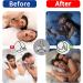 Gentle Transparent Micropore Tape 60PCS | Breathable Latex-Free Skin-Friendly for Pain-Free Removal - Buy Online on GoSupps.com