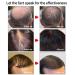 Herbal Hair-Growth Essence Spray - Anti Hair Loss Fast Grow Treatments Set - Buy Online on GoSupps.com
