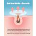 Jefusst Pimple Patch Set - 210 Hydrocolloid Acne Patches in 4 Sizes with Tea Tree & Calendula Oil - Vegan & Cruelty-Free - Buy Online on GoSupps.com