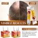 Batana Scalp Soothing Dense Hair Conditioning Roller Balls 2 Pi ces Huile De Batana Bio Pour La Croissance Des Cheveux Masque Capillaire Nourrissant Cheveux Plus pais Et Moins De Chute - Buy Online on GoSupps.com