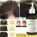 Hair Growth Shampoo Anti-Hair Loss & Hair Strengthening Shampoo Champoing for Hair Regrowth Hair Strengthening Shampoo for Hair Growth Hair Loss Shampoo for Men & Women - Buy Online on GoSupps.com