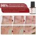 SHWORON G OU Extra Strength Foot Corn Removal Gel - 1PCS - Buy Online on GoSupps.com