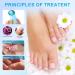 iKeener Nail Fungus Laser Treatment Device - Home Use Pain-Free Fungi Nail Remover for Fingernails & Toenails - Clean, Repair, and Cure Nail Fungus in Just 7 Minutes a Day - Don't Be Embarrassed Again! (Blue) - Buy Online on GoSupps.com