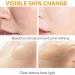 Kojic Acid Turmeric Oil Kojic Acid Serum for Dark Spots Remover Turmeric Oil Dark Spot Corrector Kojic Acid Moisturiser Glow Serum Turmeric Serum for Reduce Fine Lines Acne Face Serum Anti Aging Serum - Buy Online on GoSupps.com