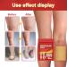 Buy Venous Plaster & Varicose Vein Stickers - Effective Spider Vein Treatment | 5 & 12 Piece Sets for Improved Blood Circulation & Reduced Swelling - Buy Online on GoSupps.com