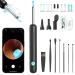 Ear wax removal Otoscope 1080p HD WiFi ear cleaner 3.5mm Otoscope ear with 6 LEDs IP67 waterproof ear mirror 360 -wide angle Otoscope camera for adults children iOS iPad and Android R1 Ultra black