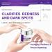 12% Azelaic Acid Facial Cream with Niacinamide & Hyaluronic Acid - Brightening & Texture Smoothing Face Cream Gentle Daily Skincare for Dull & Acne-Prone Skin 50g/1.69 oz - Buy Online on GoSupps.com