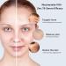 Niacinamide 10% + Zinc 1% Serum for Face | Redness Relief | Dermatologist Recommended | 30ml (1 Fl Oz - Buy Online on GoSupps.com