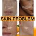 Kojic Acid & Turmeric Soap - Kojic Acid Soap for Women - Tumeric Soap Acne Dark spots Hyperpigmentation Smooth Skin - Deep Cleanses and Nourishes - Buy Online on GoSupps.com
