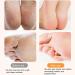 Electric Foot File | Rechargeable Skin-Friendly Foot Scrubber Dead Skin Remover - Automatic Powerful Heel Scraper for Cracked Heels Feet Hard Cracked Dry - Buy Online on GoSupps.com