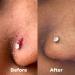 BrioCare Pierce Pro Gentle Saline Spray for Piercing & Body Mod Aftercare | Soothe Redness & Itch, Reduce Bumps | Hypochlorous HOCl Spray by BRIOTECH - Buy Online on GoSupps.com
