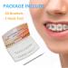 Anhuadental Orthodontic Self-Ligating Metal Bracket 0.022 Roth 345 with Hooks - 20 Brackets/Pack - Buy Online on GoSupps.com