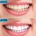 6Pcs Teeth Cleaning Plaque Removal Kit for Personal Oral Care - Buy Online on GoSupps.com