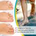 Welnove Gel Toe Protectors - 8 PCS Small + 8 PCS XS Silicone Toe Sleeves for Corns, Blisters, and Calluses - Toe Cushions for Friction Reduction and Injury Protection - Buy Online on GoSupps.com