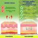 P-Beauty 42% Urea Cream | 2% Salicylic Acid | 150g Urea Foot Cream | With Aloe Vera Tea Tree Oil for Deep Hydration and Skin Softening - Buy Online on GoSupps.com