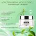 Tea Tree Acne Cream Tea Tree Acne Face Cream Pimple Cream Tea Tree Cream Acne Cream For Face Tea Tree Face Ance Gel Spot Cream for Acne Reduce Redness & Dryness Oil Control Smooth Skin - Buy Online on GoSupps.com