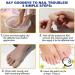 32 Pcs Patch De R paration Des Ongles De Orteils Pansements Antifongique Ongles Fungal Nail Patches Patch Traitement Mycose Ongles Pieds R paration d'Ongles Fendus R duit La D coloration - Buy Online on GoSupps.com