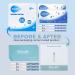 Wondfo Ovulation Test Strips Predictor Kit - 50 Count, Highly Sensitive LH Surge Detection at Home - Buy Online on GoSupps.com