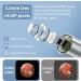 Wey7inQ Ear Cleaner Navy with 1920P FHD Camera | Wireless Ear Wax Removal Tool with 6 LED Lights | Waterproof Ear Cleaning Kit for iPhone iPad | Great Gift for Adults & Kids - Buy Online on GoSupps.com