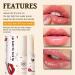 Lip Lightening for Dark Lips Lip Balm Stick Moisturizing Lip Balm Whitening & Brightening Lip Balm Lips Pink Bleaching Cream Balm Lip Balm Set Remove Dark Lips Lip Repair Balm Hydrating Lip Balm - Buy Online on GoSupps.com