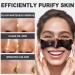 Buy Blackhead Remover Mask | Charcoal Peel Off Facial Mask for Deep Cleansing & Pore Care - All Skin Types - Buy Online on GoSupps.com