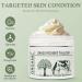 100% Organic Beef Tallow Face Moisturizer | Unscented Whipped Tallow Cream for Sensitive Skin | Grass-Fed | Nourishing Skin Care - Buy Online on GoSupps.com