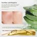 Organic Aloe Vera Hydrating Gel - Lightweight Moisturizer for Face & Body | Sunburn Scar & Acne Care - Buy Online on GoSupps.com