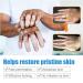 Vitiligo Therapy Cream: Soothing Ointment to Reduce White Spots & Improve Skin Pigmentation - Buy Online on GoSupps.com
