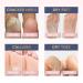 Exfoliating Peel Mask for Dry Hard Feet - Callus Remover - 2 Pack Large Size Socks - Foot Spa Treatment for Soft Healthy Feet - Buy Online on GoSupps.com