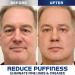 Open Eyes Awaken Peptide Lifting Eye Gel - Anti-Wrinkle Firming Treatment (2pcs) - Buy Online on GoSupps.com