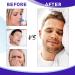 Tiuedu Nasal Strips 120 Count - Anti Snoring & Nasal Congestion Relief, Drug-Free, for Better Sleep - Buy Online on GoSupps.com