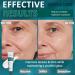 Collagen Reverse Volume Peel off Face Masks Collagen Face Mask - Deep Collagen Anti Wrinkle Lifting Mask - Collagen for Skin Tightening Korean Skin Care Facial Mask Beauty Skincare - Buy Online on GoSupps.com