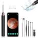 Ear Wax Removal - Ear Cleaner with Camera  Ear Wax Remover Otoscope with Light  Ear Wax Removal Tool  Ear Cleaning Kit with 6 Pcs Ear Set  WiFi Connected  for iPhone  iPad  Android Phones