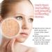 Brightening Clearing Serum Dark Spot Lightening Lotion Faded Serum for Dark Spots Faded Serum Faded Serum For Scars And Dark Spots Effectively Lighten Melanin Deposits and Skin Tone - Buy Online on GoSupps.com