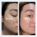 Geologie Clear System | 3-Step Acne Treatment Set for Men & Women | Fast Skin Clearing with Acne Gel Cleanser SPF15 Day Cream & Retinol Face Cream | Level 3 - 3pc - Buy Online on GoSupps.com