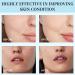 Hydrating Gel Face Cream - Moisturiser Face Women - Face Cream for Women - Sodium hyaluronate Ingredients - Moisturiser for Dry Skin - Light Texture and Easy Absorption - Buy Online on GoSupps.com