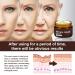 Retinol Anti-Aging Wrinkle Removal Firming Facial Cream Set - 3Pcs - Buy Online on GoSupps.com